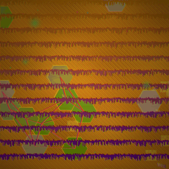 The Surgical Memory Palace