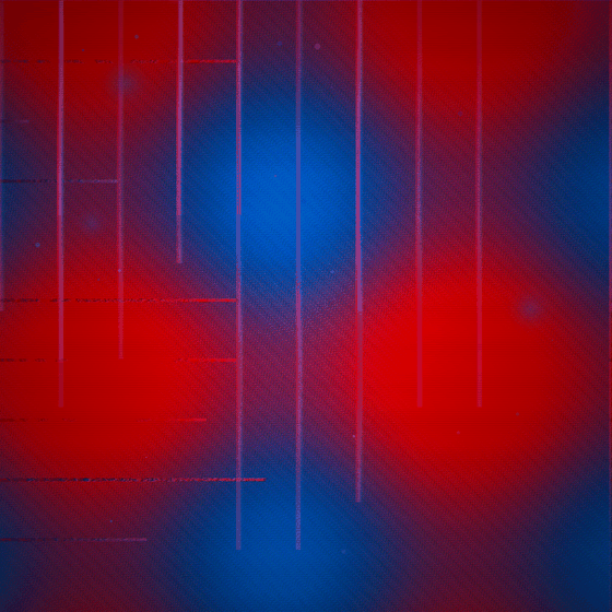 The Recovery That Weeps Static