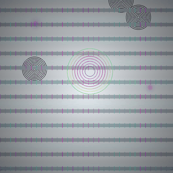 The Phantom Digit Syndrome